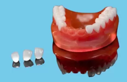 DETEC ZIRCONIA HT/ST - GIẢI PHÁP THAY THẾ RĂNG KIM LOẠI VÀ RĂNG KIM LOẠI PHỦ SỨ