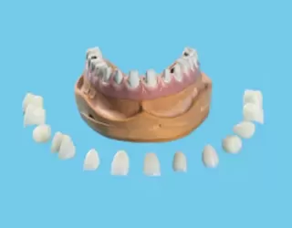 CẤY GHÉP IMPLANT - GIẢI PHÁP TỐI ƯU CHO NGƯỜI BỊ MẤT RĂNG LÂU NĂM