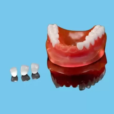 Răng sứ Detec Zirconia ST trên Implant